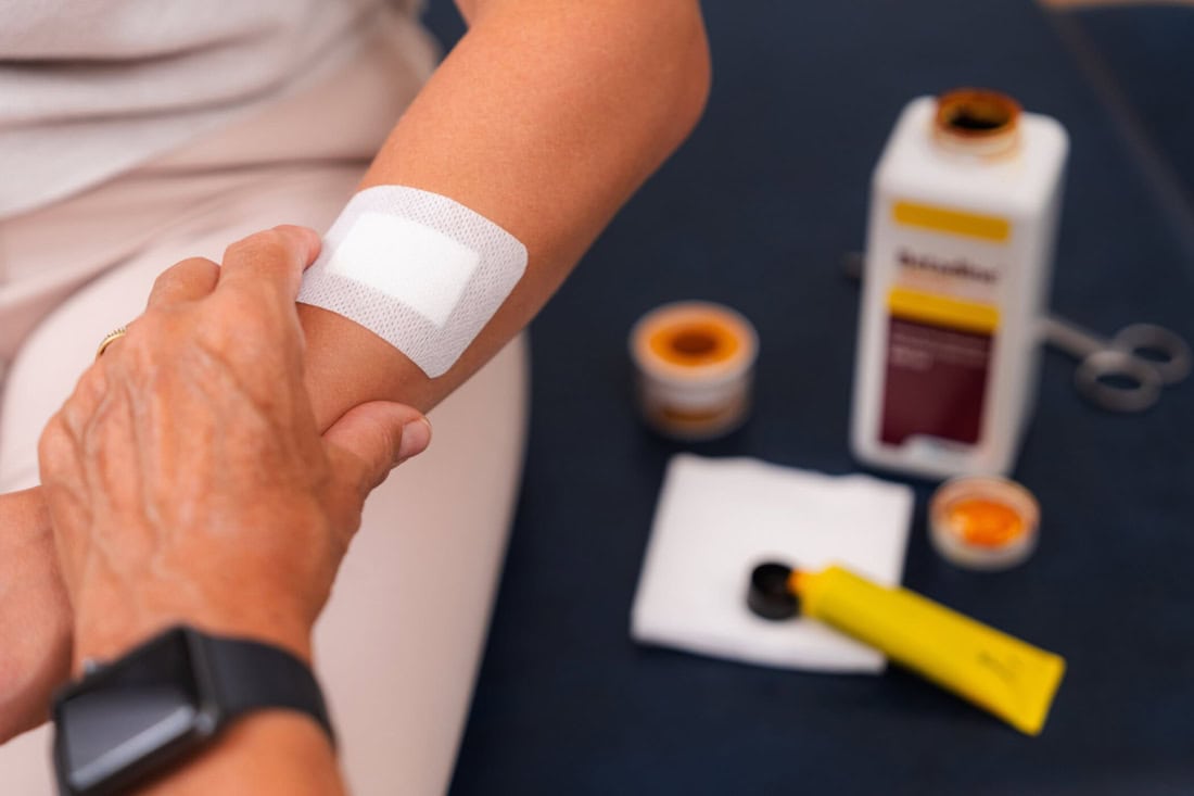 Wound care after surgery at GP, dressing change and wound care products.